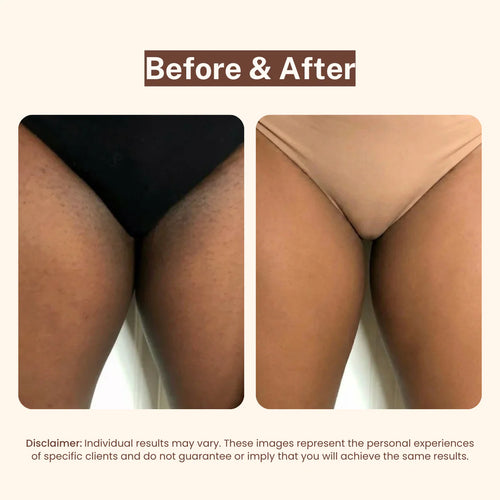 Bikini Line Serum